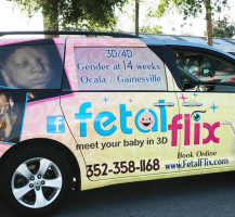 Fetal Flix